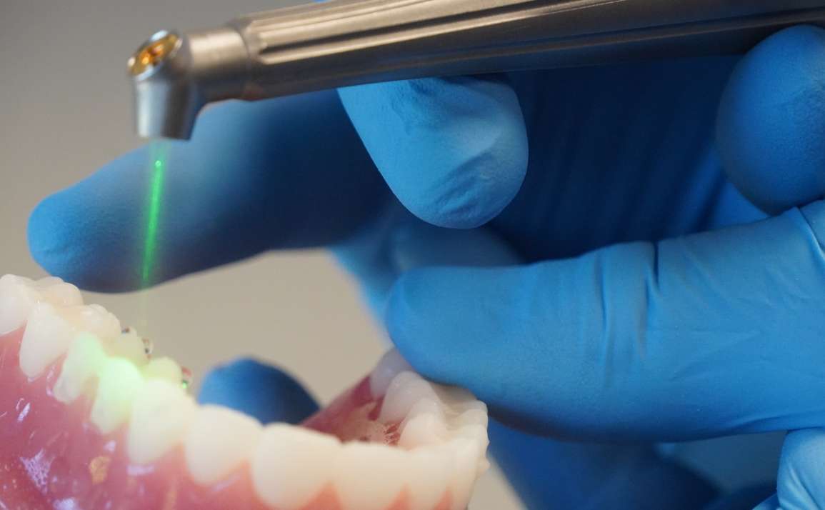 Laser Dentistry: The New Way to Treat the Smile