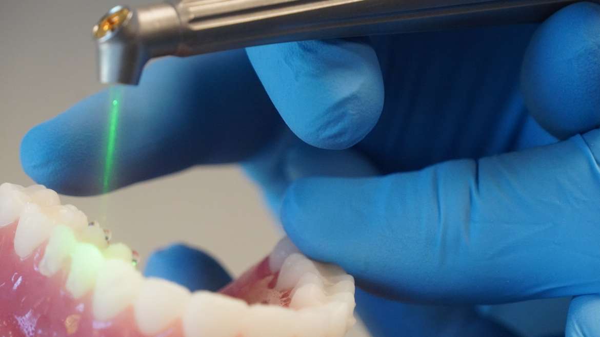 Laser Dentistry: The New Way to Treat the Smile
