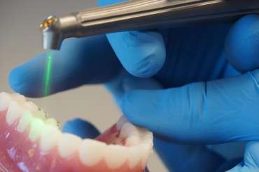 Laser Dentistry: The New Way to Treat the Smile