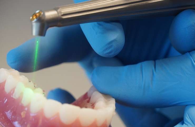 Laser Dentistry: The New Way to Treat the Smile