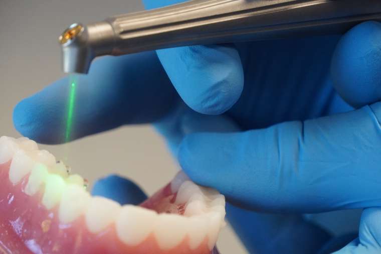 Laser Dentistry: The New Way to Treat the Smile
